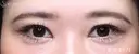 【30代女性・目力を改善】眼瞼下垂手術＋目頭切開（4ヶ月後） 120日後 サムネイル用