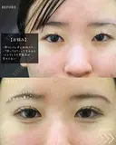 目元コンプレックス解消👀💖 before画像 サムネイル用