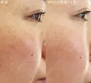エリシスセンス before画像 サムネイル用