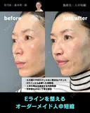 人中短縮 0日後 サムネイル用