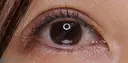 【30代女性・ハム目を改善して睫毛のキワを見せたい！！】睫毛上皮膚切開（7日後・抜糸時） 7日後 サムネイル用