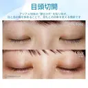 【20代女性・大人っぽい平行型の二重に】目頭切開 before画像 サムネイル用