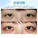 【20代女性・大人っぽい平行型の二重に】目頭切開 after画像 サムネイル用
