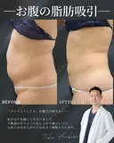 夏までに本気瘦せ！🌻 before画像 サムネイル用