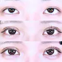 アリエルクイックループダブル二重埋没法/涙袋ヒアルロン酸 before画像 サムネイル用