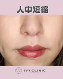 人中短縮 after画像 サムネイル用