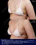 脂肪幹細胞豊胸術（セリューション豊胸術） after画像 サムネイル用