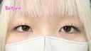 エターナル二重術 before画像 サムネイル用