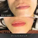 アートメイク(唇) after画像 サムネイル用