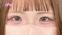 エターナル二重術 after画像 サムネイル用