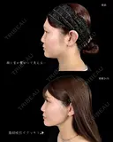 🎀顎下脂肪吸引🎀 before画像 サムネイル用