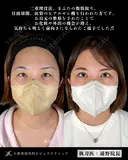 Dr浦野執刀🎀二重埋没法 after画像 サムネイル用