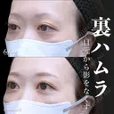 裏ハムラ before画像 サムネイル用