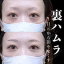 裏ハムラ 30日後 サムネイル用