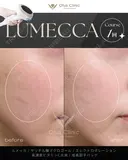 ルメッカ before画像 サムネイル用