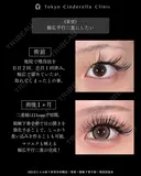 たるみ取り併用全切開法二重術/眼瞼下垂手術/埋没法抜糸/MD式 before画像 サムネイル用