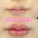 Cカールリップ before画像 サムネイル用