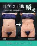 目立つ下腹解消！🌟 after画像 サムネイル用