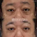 表ハムラ before画像 サムネイル用