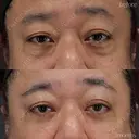 表ハムラ after画像 サムネイル用