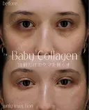ベビーコラーゲン after画像 サムネイル用
