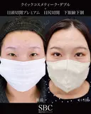クイックコスメティーク・ダブル・目尻切開・下眼瞼下制・目頭切開 before画像 サムネイル用