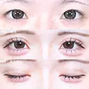 アリエルクイックループトリプル二重埋没法/涙袋ヒアルロン酸 7日後 サムネイル用
