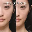 オンダリフト after画像 サムネイル用