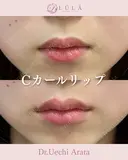 Cカールリップ after画像 サムネイル用