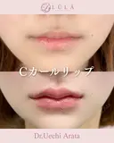 Cカールリップ after画像 サムネイル用