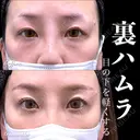 裏ハムラ before画像 サムネイル用