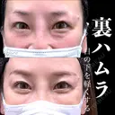 裏ハムラ 180日後 サムネイル用