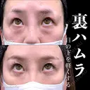 裏ハムラ 180日後 サムネイル用
