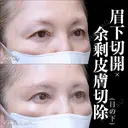 眉下切開･余剰皮膚切除(目の下) before画像 サムネイル用