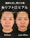 余白を削りゆるみのないシャープな輪郭を作ろ 0日後 サムネイル用