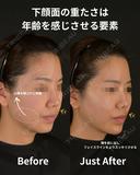 余白を削りゆるみのないシャープな輪郭を作ろ 0日後 サムネイル用