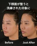 余白を削りゆるみのないシャープな輪郭を作ろ 0日後 サムネイル用