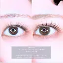 アリエルクイックループダブル二重埋没法/涙袋ヒアルロン酸 before画像 サムネイル用