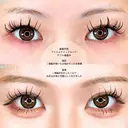 アリエルクイックダループダブル二重埋没法/涙袋ヒアルロン酸 before画像 サムネイル用