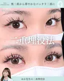 二重埋没法 before画像 サムネイル用