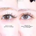 目頭切開/目尻切開/アリエルクイックループトリプル二重埋没法 before画像 サムネイル用