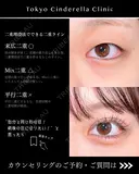 二重埋没法(韓国式自然癒着法6点) before画像 サムネイル用
