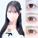 アリエルクイックループダブル二重埋没法/まぶたの脂肪取り 90日後 サムネイル用