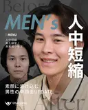 人中短縮（鼻柱切開）・鼻翼縮小・鼻翼挙上・鼻孔縁挙上  90日後 サムネイル用