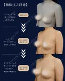 ナチュラルにサイズアップ🩷 before画像 サムネイル用