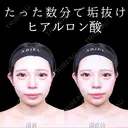顎ヒアルロン酸 0日後 サムネイル用