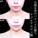 顎ヒアルロン酸 before画像 サムネイル用