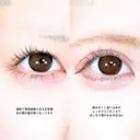 アリエルクイックループダブル二重埋没法  before画像 サムネイル用