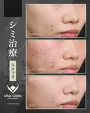 ルメッカ 14日後 サムネイル用