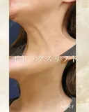ボトックスリフト before画像 サムネイル用